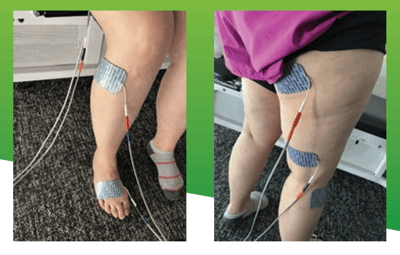 Back Pain Case Study Image 4