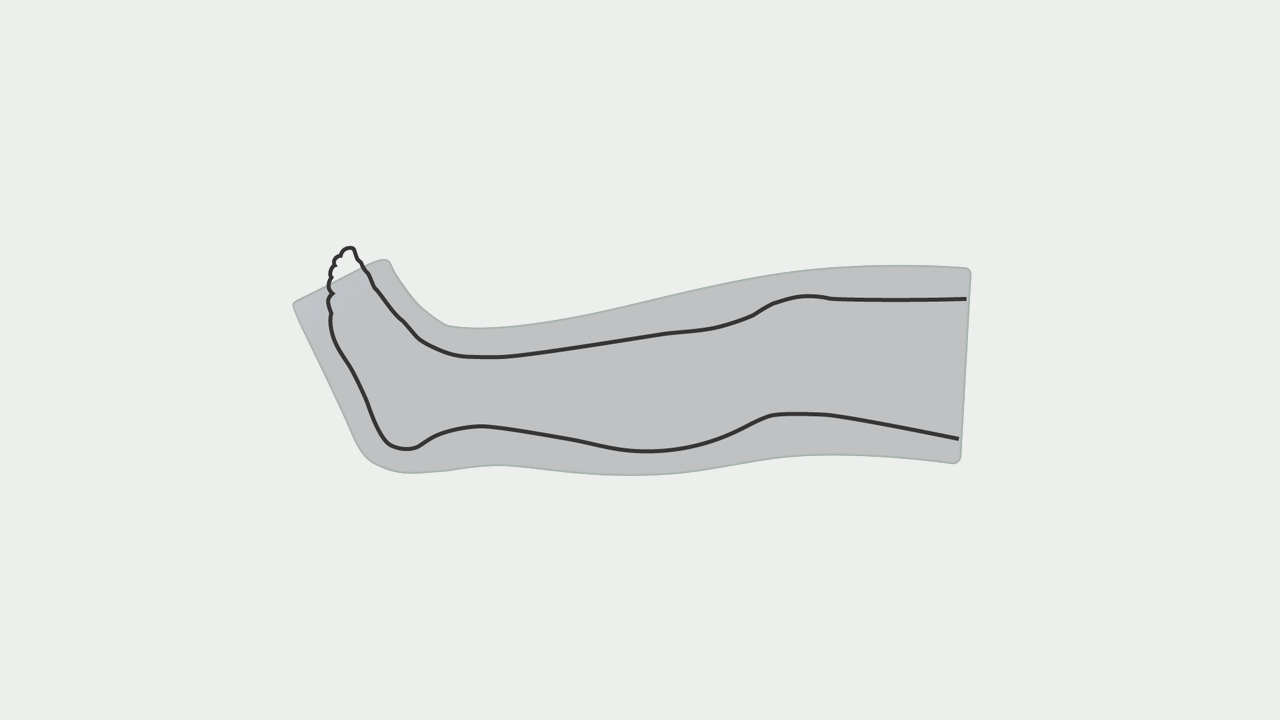 Revive leg boot inflation and deflation
