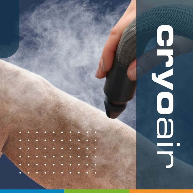 A persons leg being treated with local cryotherapy for the benefits.